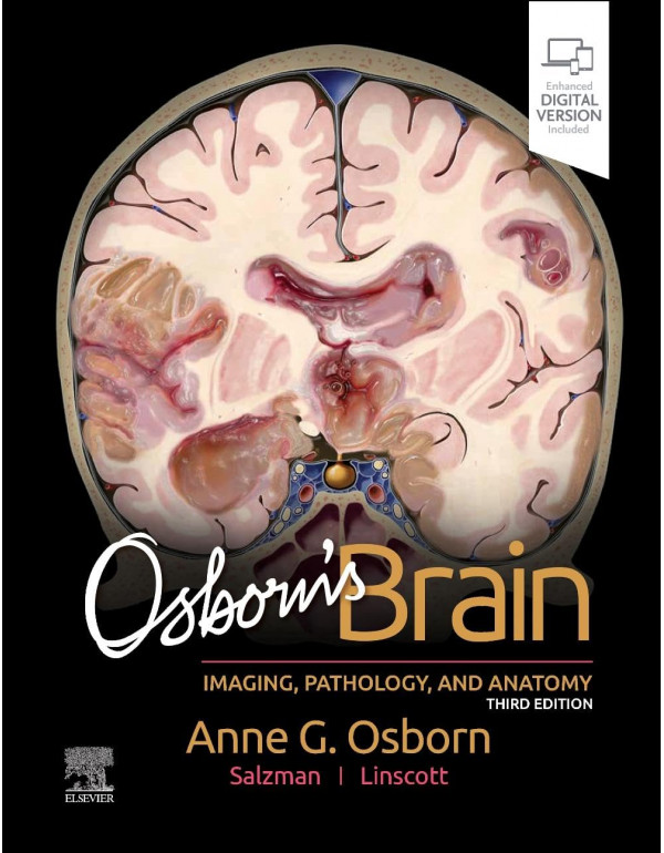 Osborn's Brain *US HARDCOVER* 3rd Ed. by Anne Osborn, Luke Linscott, Karen Salzman - {9780443109379} {0443109370}