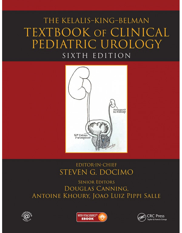 The Kelalis--King--Belman Textbook of Clinical Pediatric Urology *US HARDCOVER* 6th Ed. Textbook of Clinical Pediatric Urology by Steven Docimo